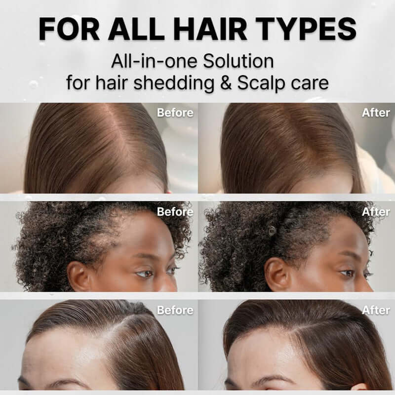Hair Growth Scalp Serum bottle